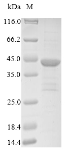 Human DDAH1 protein
