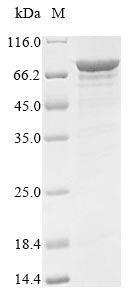Human DDX5 protein