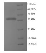 Human DHFR protein