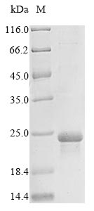 Human EGFR protein