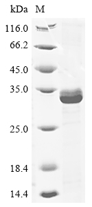 Human CELA3B protein