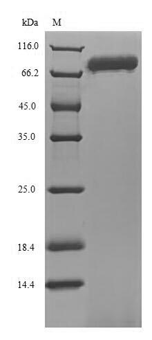 Human ENOX1 protein