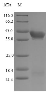 Human Estrogen Receptor beta protein
