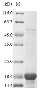 Bacteria Paracoccus denitrificans Electron transfer flavoprotein-ubiquinone oxidoreductase protein