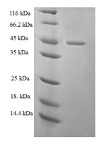 Human EZR protein