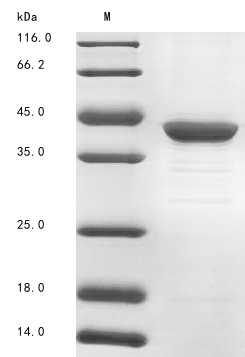 Human FBP1 protein