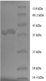 Human FKBP1A protein