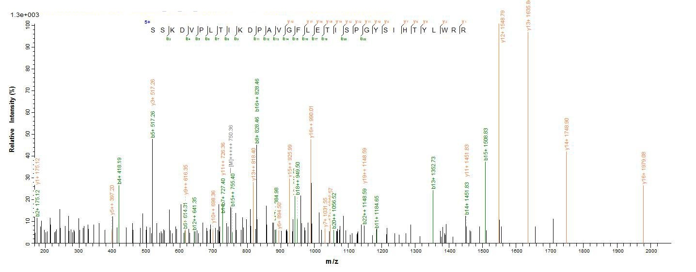 Human GBA protein