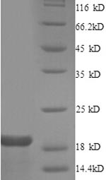 Human GJA1 protein