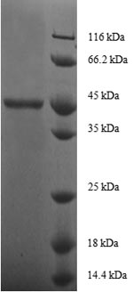 Human GM2A protein