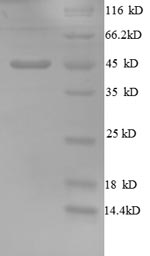 Human GP73 protein