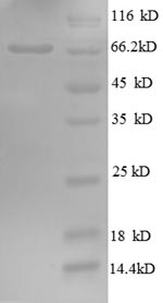 Human GP73 protein