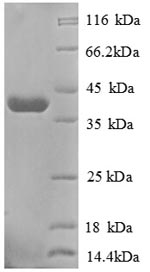 Human GP73 protein