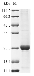 Human HBG2 protein