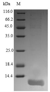 Human Orexin Receptor protein