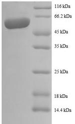 Human IL12B protein