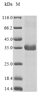 Mouse Khk protein