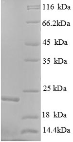 Human KRAS protein