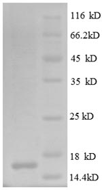 Human CD106 protein