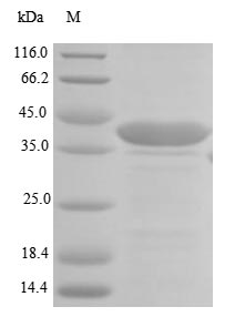 Human LAMB1 protein