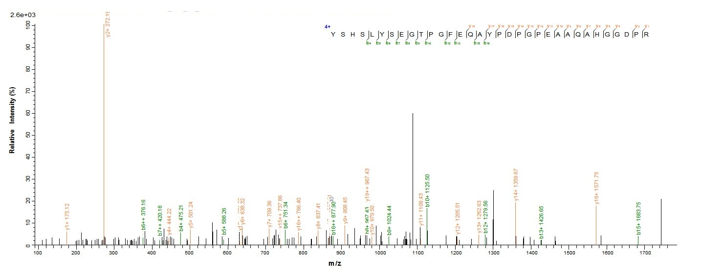 Human LOXL1 protein