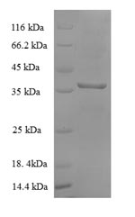 E. coli mdh protein