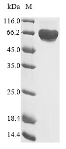 Human MET protein
