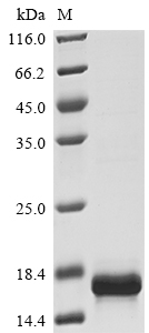 Human MIF protein