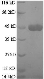 Mouse Mmp13 protein