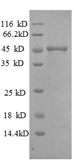 Human MMP7 protein