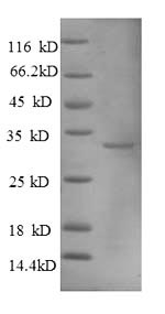 Human MT1A protein