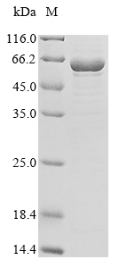 Rat Nefl protein