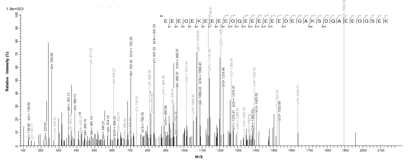 Human NEFM protein