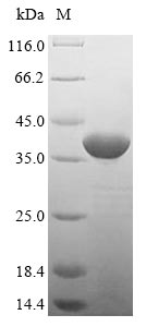 Virus YNK1 protein