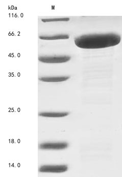 Human NPEPPS protein