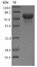 Human Glucocorticoid Receptor protein