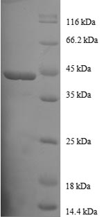 Human PFN1 protein