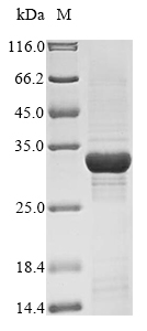 Human PPARD protein