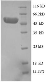 Human PSME3 protein