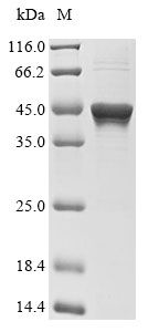 Human PTPN1 protein