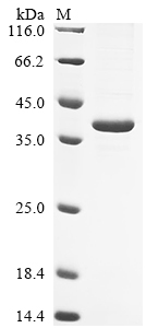 Mouse Qpct protein