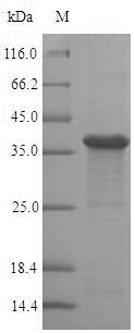 Human RAB8A protein