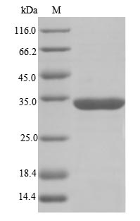 Human RBMX protein