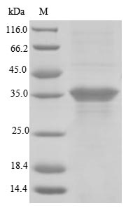 Human RHD protein