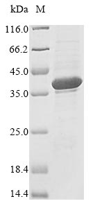 Human RNASEH1 protein