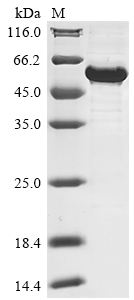Human RORA protein