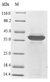 Human RPSA protein