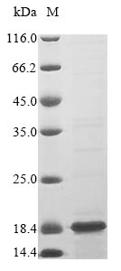 Human S100A10 protein