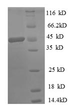 Human SAT1 protein