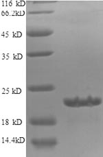 Human SAT1 protein
